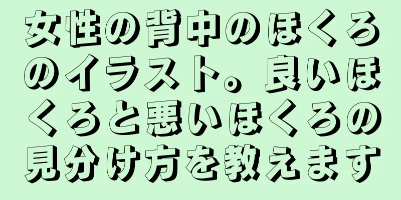 女性の背中のほくろのイラスト。良いほくろと悪いほくろの見分け方を教えます