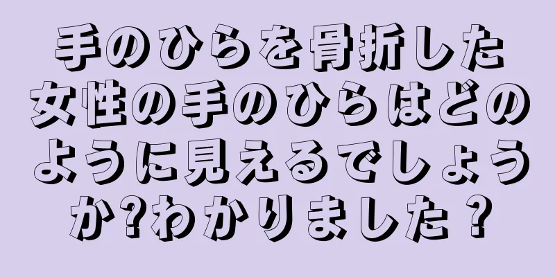 手のひらを骨折した女性の手のひらはどのように見えるでしょうか?わかりました？