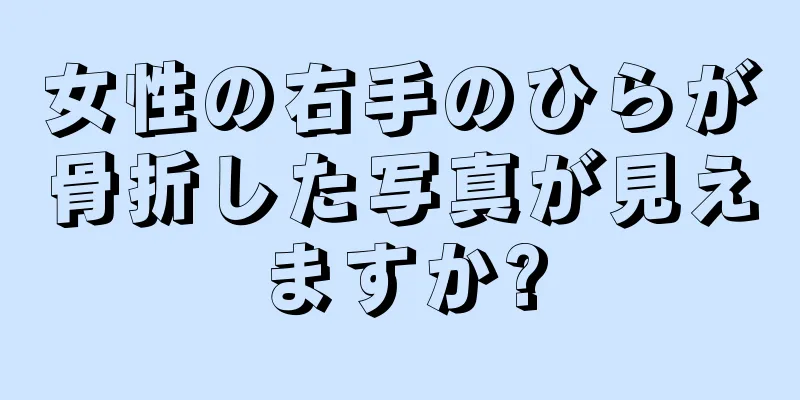 女性の右手のひらが骨折した写真が見えますか?