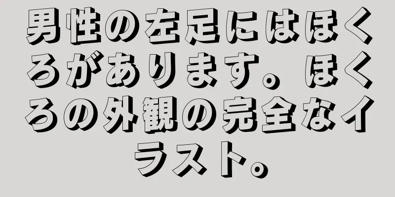 男性の左足にはほくろがあります。ほくろの外観の完全なイラスト。