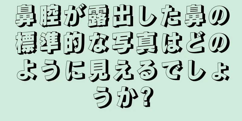 鼻腔が露出した鼻の標準的な写真はどのように見えるでしょうか?