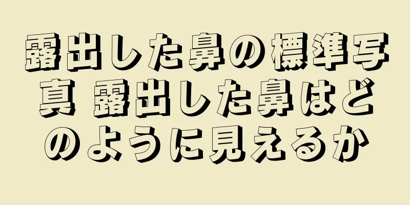 露出した鼻の標準写真 露出した鼻はどのように見えるか