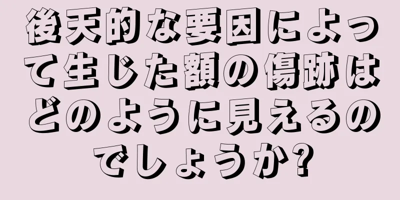 後天的な要因によって生じた額の傷跡はどのように見えるのでしょうか?