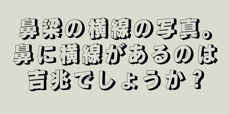 鼻梁の横線の写真。鼻に横線があるのは吉兆でしょうか？