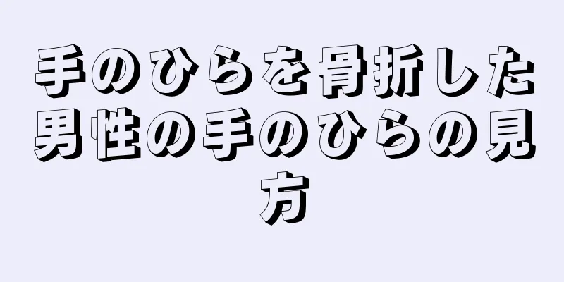 手のひらを骨折した男性の手のひらの見方