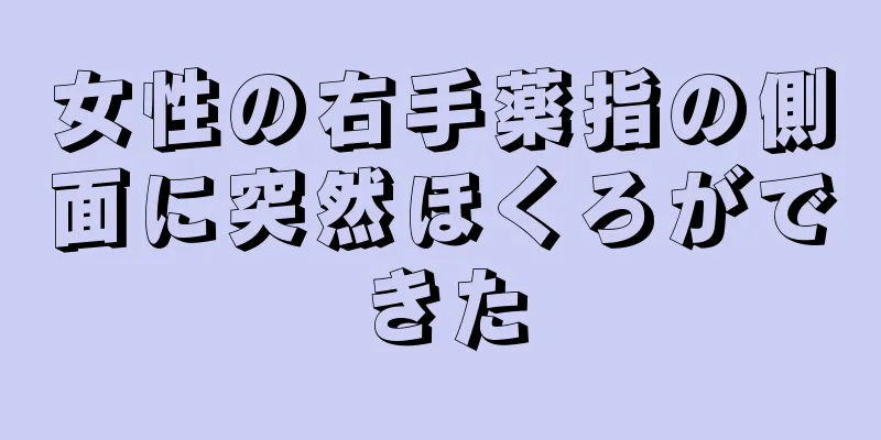 女性の右手薬指の側面に突然ほくろができた