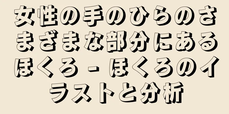 女性の手のひらのさまざまな部分にあるほくろ - ほくろのイラストと分析