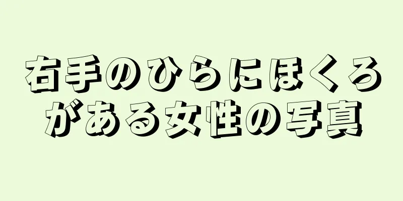 右手のひらにほくろがある女性の写真